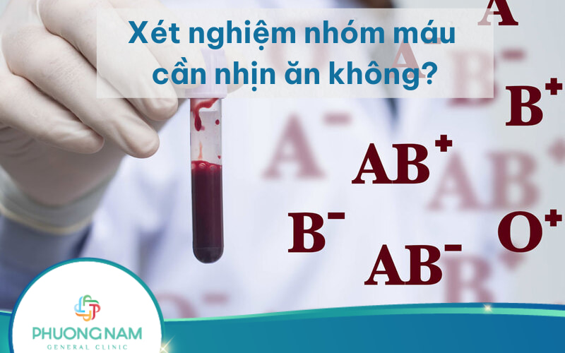 Xét nghiệm nhóm máu có cần nhịn ăn không? Và các loại xét nghiệm máu cần nhịn ăn