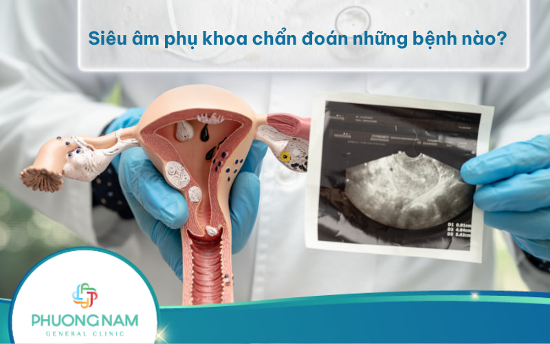 Siêu âm phụ khoa chẩn đoán được những bệnh nào? Khi nào nên đi siêu âm phụ khoa?