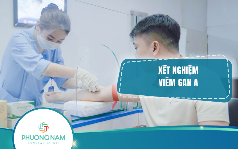 Xét nghiệm viêm gan A là gì, có ý nghĩa gì với cuộc sống của chúng ta?
