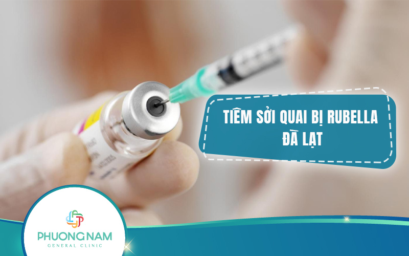 Tiêm phòng sởi, quai bị, rubella tại Đà Lạt: Bảo vệ sức khỏe cho bạn và gia đình