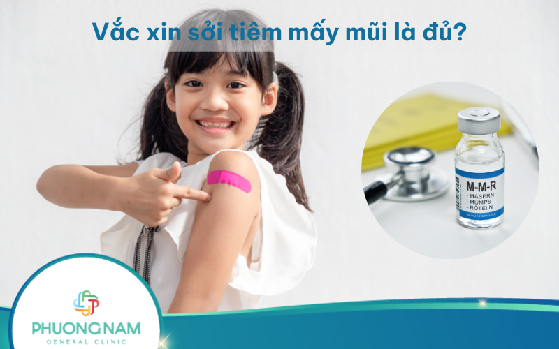 Vắc xin sởi tiêm mấy mũi là đủ? Lịch tiêm cụ thể của từng loại vacxin