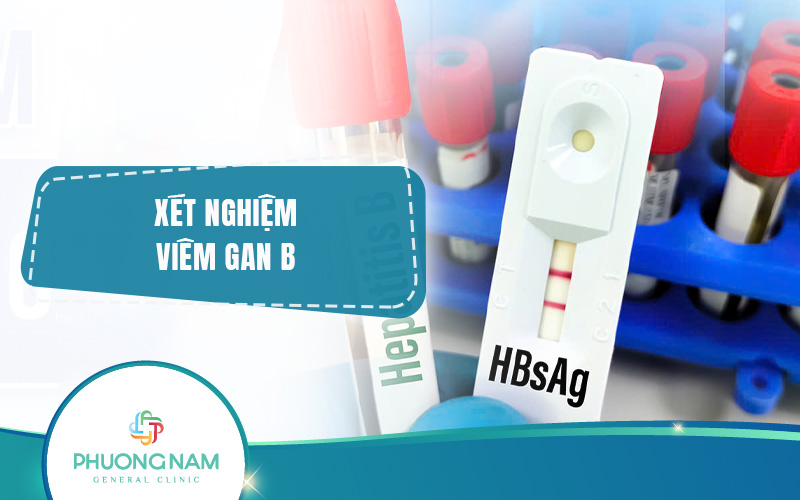 Xét nghiệm Viêm gan B: Ý nghĩa, phân loại, đối tượng, chi phí & quy trình
