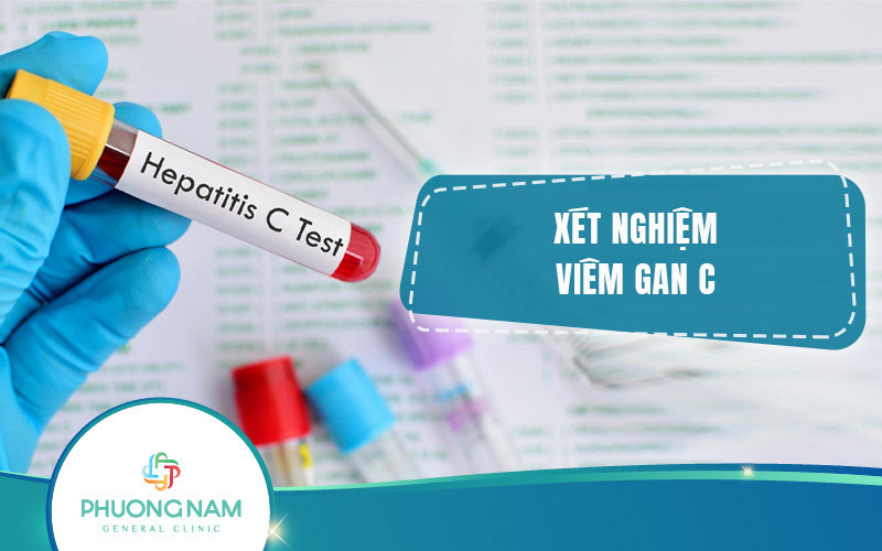 Xét nghiệm viêm gan C: ý nghĩa, phân loại, chi phí & quy trình
