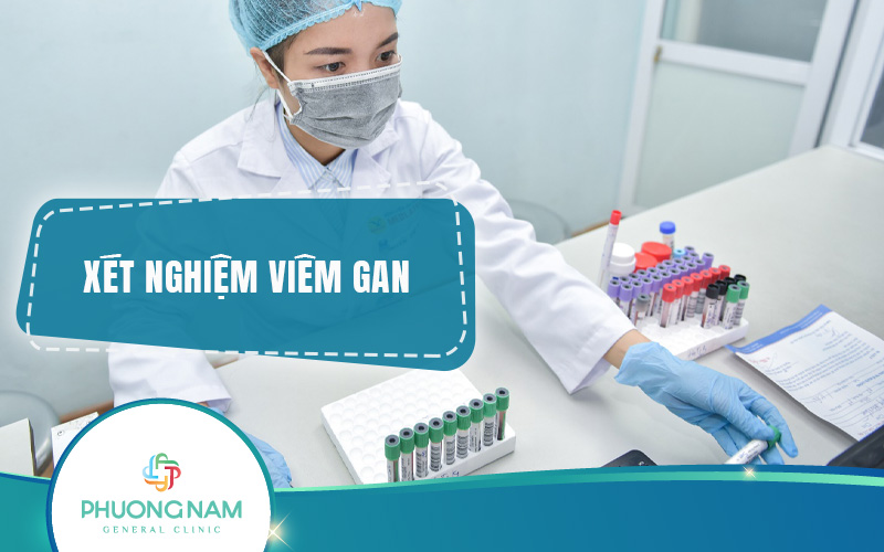 Xét nghiệm viêm gan: Đối tượng, ý nghĩa, phân loại, chi phí & quy trình