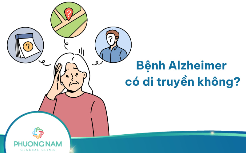 Bệnh Alzheimer có di truyền không? Và các nguyên nhân ảnh hưởng đến trí nhớ!
