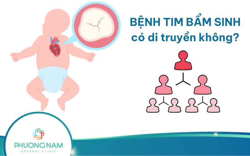 Bệnh tim bẩm sinh có di truyền không (từ bố mẹ)? Nguyên nhân, triệu chứng như thế nào?