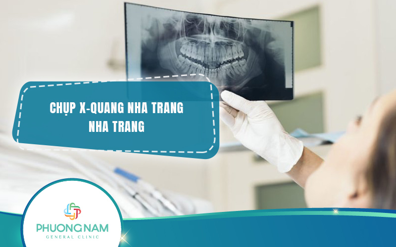Địa chỉ Chụp X quang Nha Trang uy tín, chất lượng, nhanh chóng