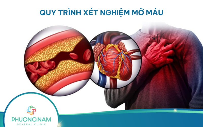 Quy trình xét nghiệm máu nhiễm mỡ diễn ra như thế nào?