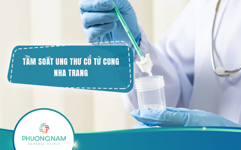 Địa chỉ Tầm soát ung thư cổ tử cung Nha Trang uy tín, nhanh chóng
