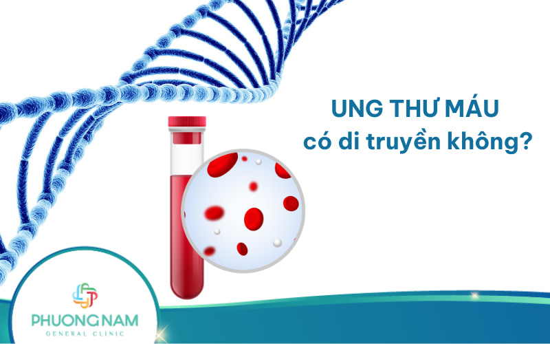 Ung thư máu có di truyền không? Nguyên nhân & cách phòng ngừa bệnh!