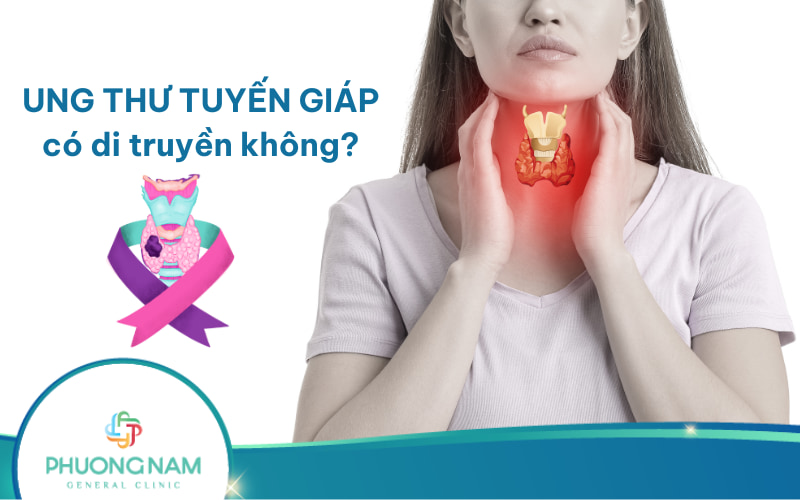Ung thư tuyến giáp có di truyền không? Nguyên nhân & cách phòng bệnh