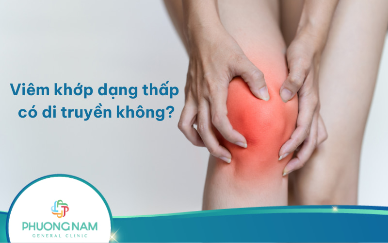 Viêm khớp dạng thấp có di truyền không? Cách phòng ngừa như thế nào?