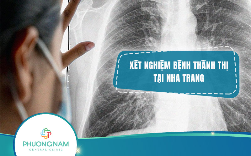 Địa chỉ xét nghiệm bệnh thành thị Nha Trang uy tín, chất lượng