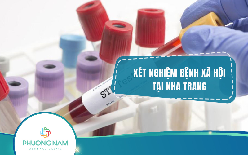 TOP 5 địa chỉ xét nghiệm bệnh xã hội Nha Trang uy tín