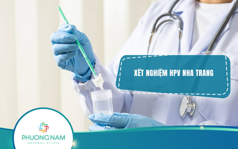 Địa chỉ Xét nghiệm HPV Nha Trang chính xác, uy tín, chất lượng