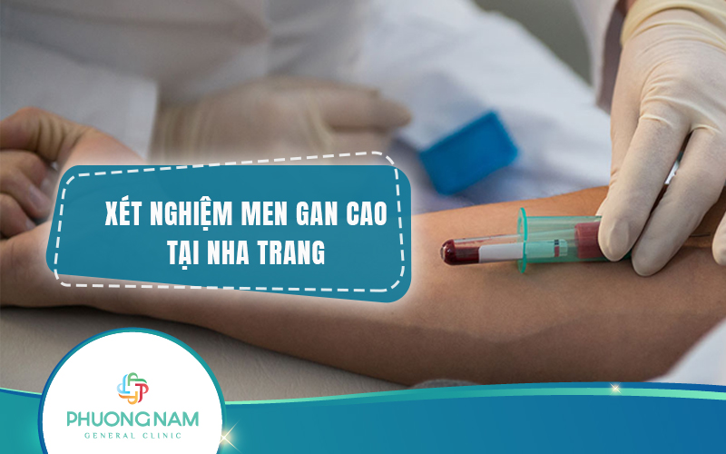 Địa chỉ xét nghiệm men gan cao Nha Trang uy tín, chất lượng