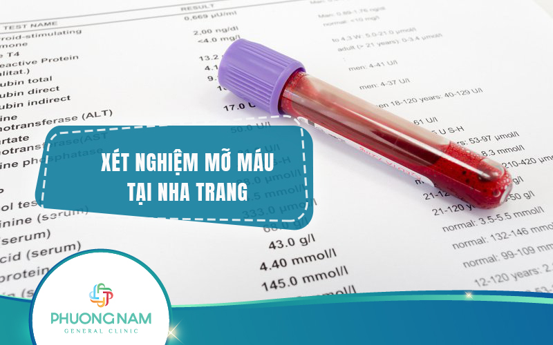 Địa chỉ xét nghiệm mỡ máu Nha Trang uy tín