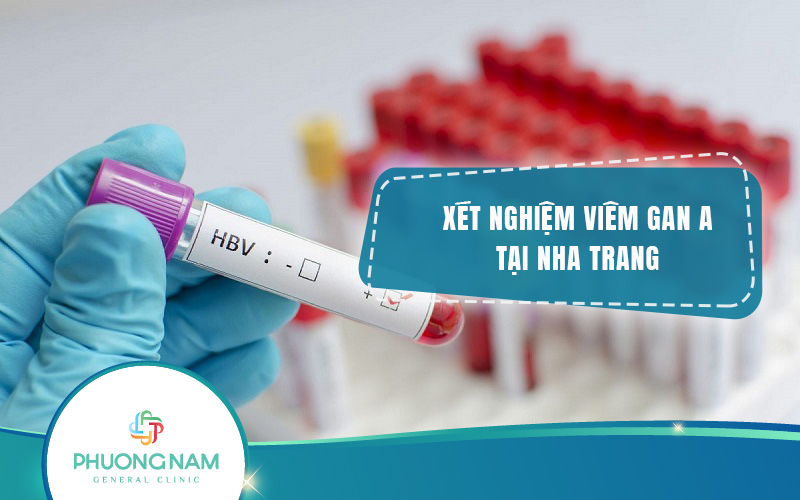 Địa chỉ xét nghiệm viêm gan Nha Trang uy tín, chất lượng