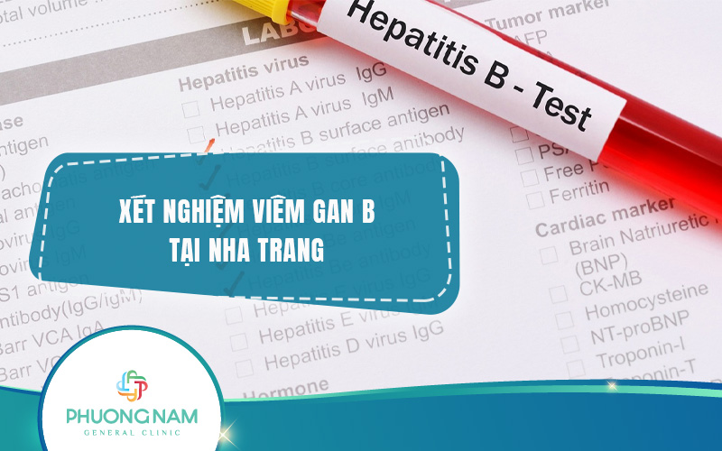 Địa chỉ Xét nghiệm Viêm gan B tại Nha Trang chính xác, nhanh chóng