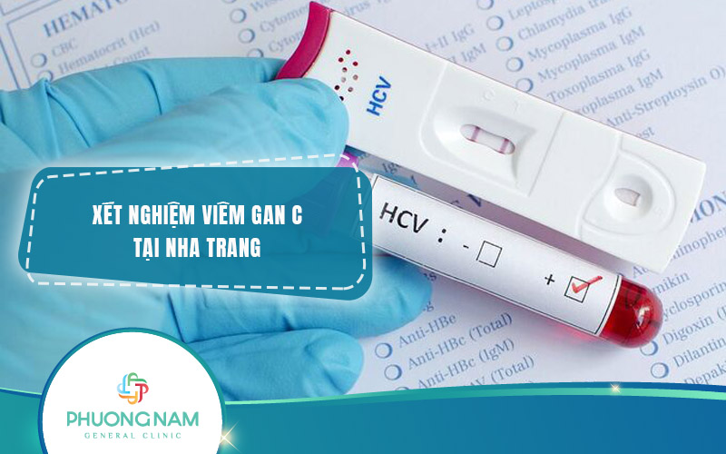 Địa chỉ Xét nghiệm Viêm Gan C Nha Trang uy tín, chính xác, giá tốt