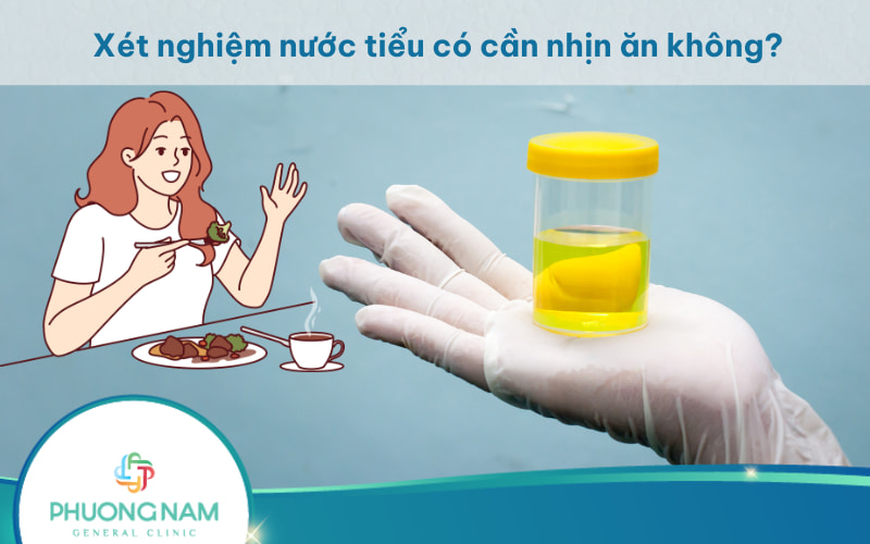 Xét nghiệm nước tiểu có cần nhịn ăn không? Lưu ý khi xét nghiệm