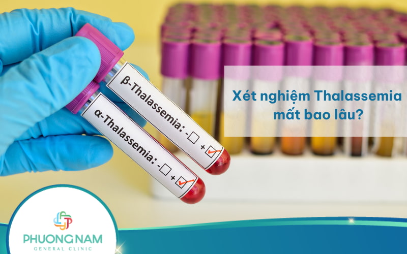 Xét nghiệm Thalassemia mất bao lâu? Và bao lâu thì có kết quả?