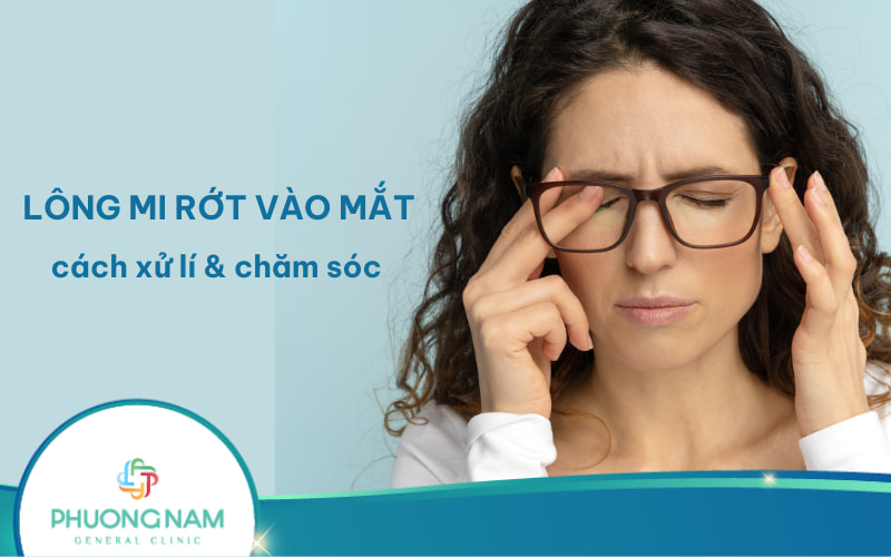 Bị lông mi rớt vào mắt: Cách xử lý và chăm sóc đúng cách