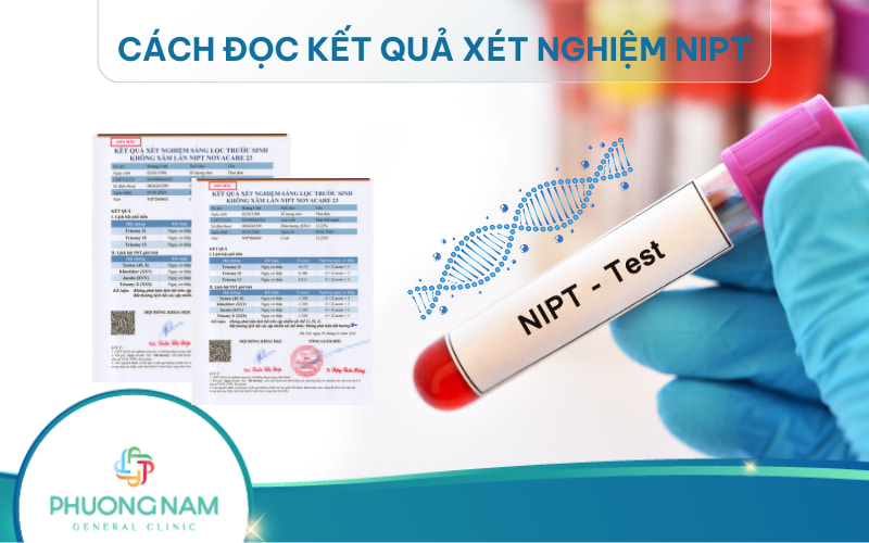 Hướng dẫn cách đọc kết quả xét nghiệm NIPT và hiểu rõ