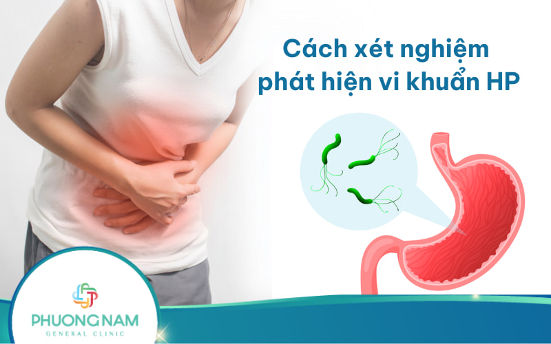Cách xét nghiệm phát hiện vi khuẩn HP hiện nay đang được áp dụng