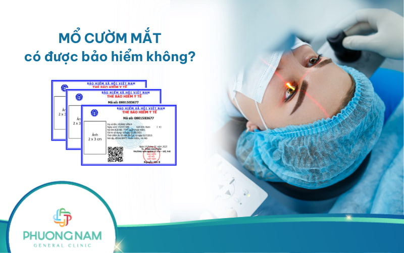 Mổ cườm mắt có được bảo hiểm không? Và được chi trả bao nhiêu?