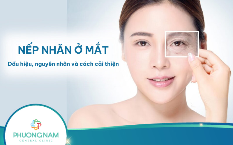 Nếp nhăn ở mắt: Dấu hiệu, nguyên nhân và cách cải thiện