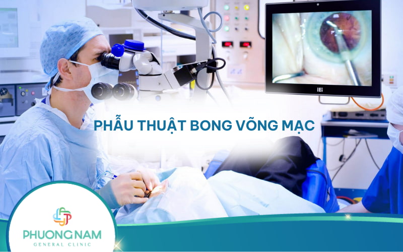 Phẫu thuật bong võng mạc có nguy hiểm không? Quy trình và lưu ý