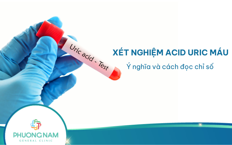 Xét nghiệm acid uric máu là gì? Quy trình thực hiện, cách đọc chỉ số