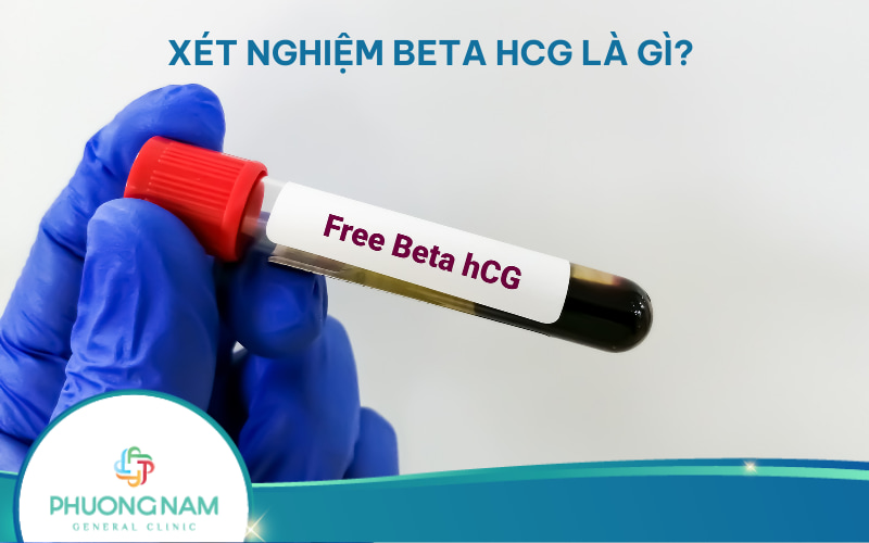 Xét nghiệm HCG là gì? Ý nghĩa và quy trình xét nghiệm