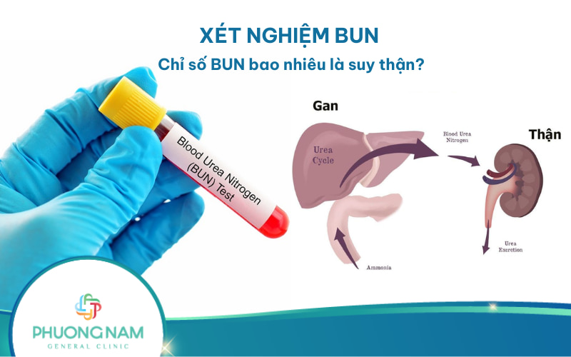 Xét nghiệm BUN là gì? Ý nghĩa chỉ số xét nghiệm BUN