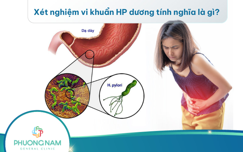 Xét nghiệm vi khuẩn HP dương tính nghĩa là gì?