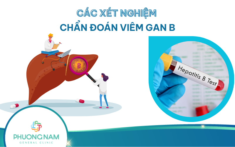 Ý nghĩa các xét nghiệm viêm gan B