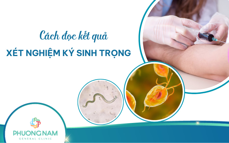 Hướng dẫn cách đọc kết quả xét nghiệm ký sinh trùng chi tiết