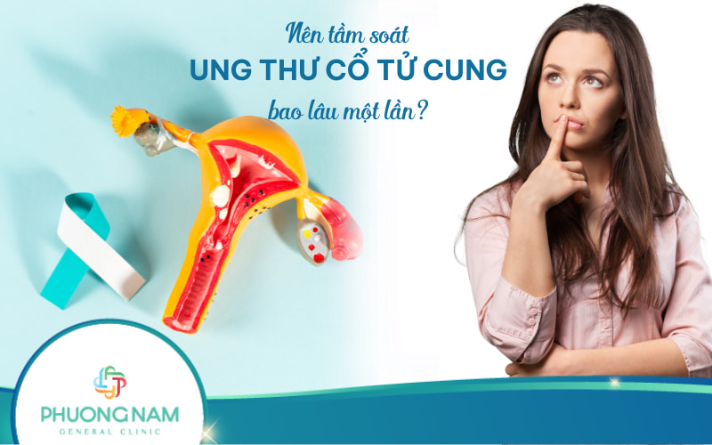 Nên tầm soát ung thư cổ tử cung bao lâu một lần? Và bắt đầu từ lúc nào?