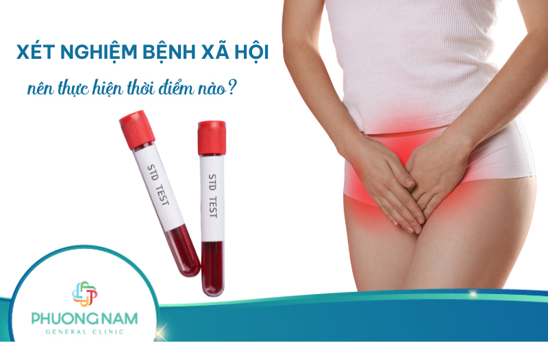 Thời điểm nào cần phải đi xét nghiệm bệnh xã hội?