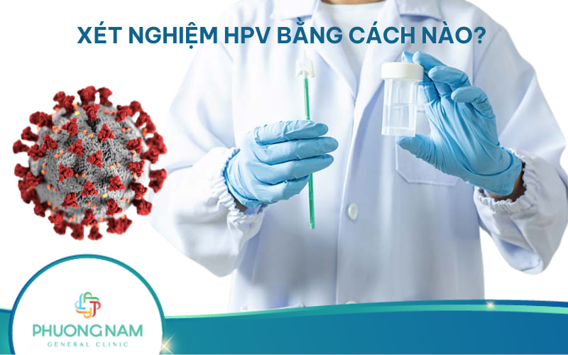 Xét nghiệm HPV bằng cách nào và quy trình như thế nào?
