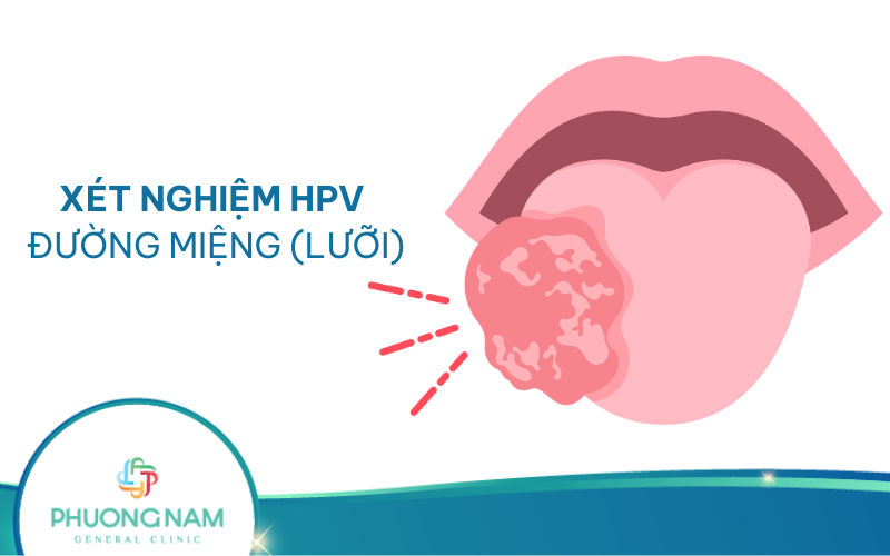 Xét nghiệm HPV đường miệng (lưỡi) có được không?