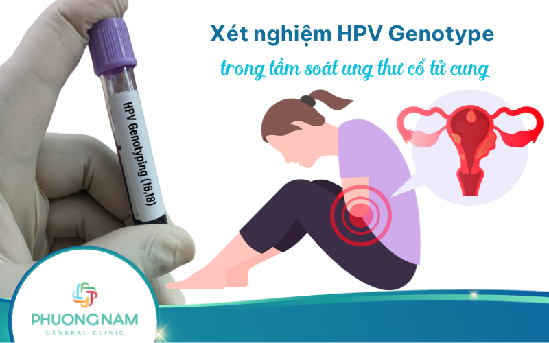 Xét nghiệm HPV Genotype trong tầm soát ung thư cổ tử cung
