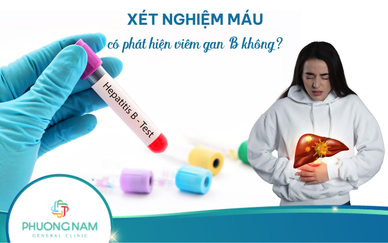 Xét nghiệm máu có phát hiện viêm gan B không?