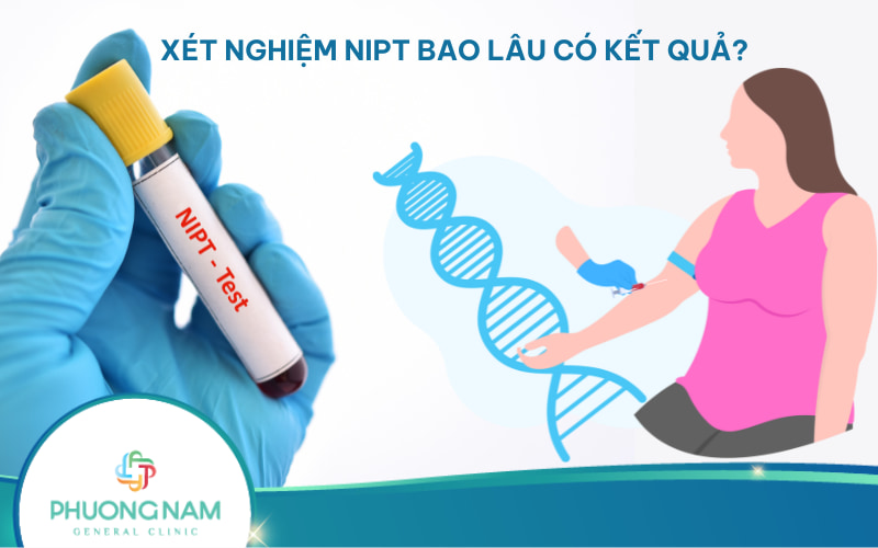 Xét nghiệm NIPT bao lâu có kết quả? Và ý nghĩa kết quả xét nghiệm