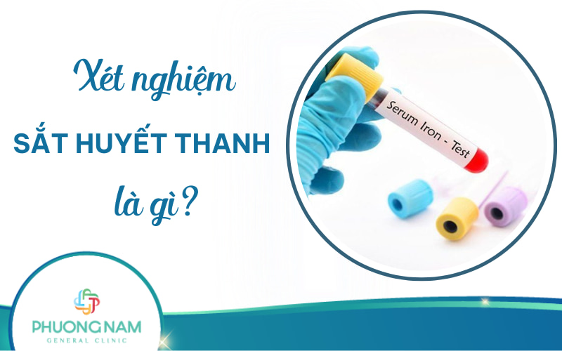 Xét nghiệm sắt huyết thanh là gì? Lợi ích, ý nghĩa kết quả và lưu ý khi thực hiện