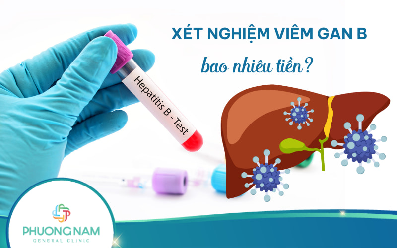 Xét nghiệm viêm gan B bao nhiêu tiền? Giá ở một số bệnh viện lớn!