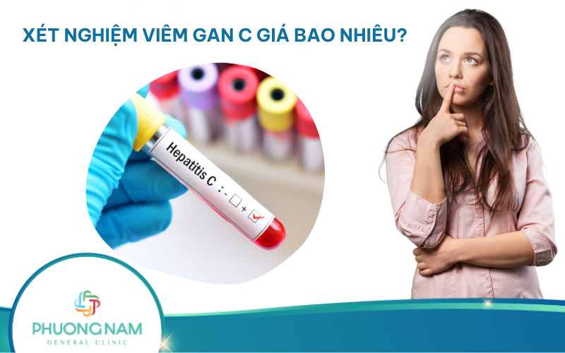 Xét nghiệm viêm gan C bao nhiêu tiền? Tham khảo Giá ở những bệnh viện lớn ở Việt Nam!