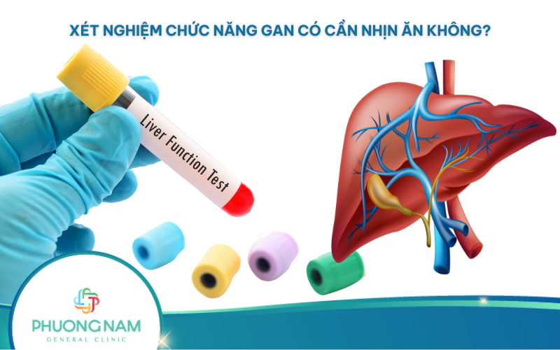 Trước xét nghiệm chức năng gan có cần nhịn ăn không?