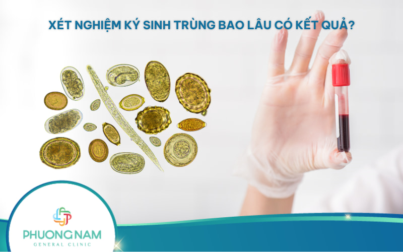 Xét nghiệm ký sinh trùng bao lâu có kết quả? Và dấu hiện nhiễm ký sinh trùng